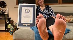 Woman With World’s Largest Feet Struggles to Find Size 18 Shoes