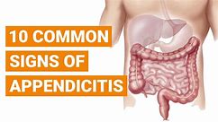 10 Common Signs of Appendicitis