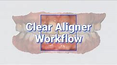 Clear Aligner Workflow