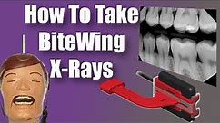 Bitewings X Rays - Dental Tips and Tricks