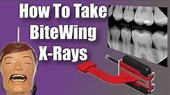 Bitewings X Rays - Dental Tips and Tricks