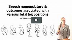 Breech nomenclature and the risks/outcomes of various fetal presentations