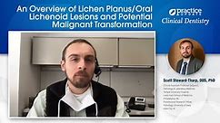 An Overview of Lichen Planus/Oral Lichenoid Lesions and Potential Malignant Transformation