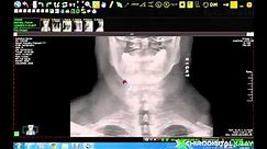Chiropractic Digital X-ray Software | Basic Viewing Tools