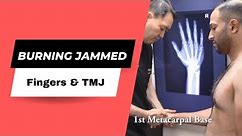 Physician Assistant Burning Jammed Fingers, Hand spasms, and TMJ Dr Suh Gonstead Chiropractic in NYC