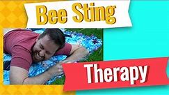 Bee Sting Therapy - Apitherapy On My Back