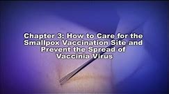 Chapter 3: How to Care for the Smallpox Vaccination Site and Prevent the Spread of Vaccinia Virus