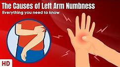 The Causes Of Left Arm Numbness