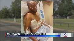 West Memphis man says undercover officers beat him outside apartments