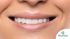 Home Remedies For Teeth Whitening By Dr. Siddharth Gupta - PharmEasy Blog