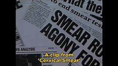 Cervical Smear