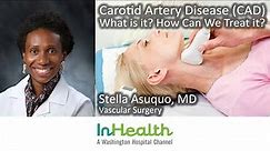 Carotid Artery Disease (CAD): What Is It? How Can We Treat It?