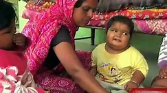 Tv9 IMPACT - Government to bear treatment cost of three obese kids, Gir Somnath