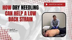 How Dry Needling can help a Low Back Strain - Your Burlington NC Chiropractor