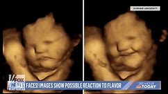 Pro-lifers highlight NBC segment showing 'babies in the womb' can react to flavor