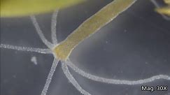 Hydra Under the Microscope