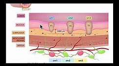 Colonoscopy: Colon wall anatomy for EMR and ESD - Medical Illustration