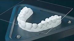 The Next Generation in Clear Aligners | Reveal®