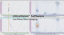 UltraVision® for Live Plane Wave Imaging