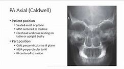 Radiographic Positioning of the Facial Bones