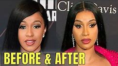 Cardi B: Plastic and Cosmetic Surgery