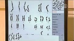 FWU - Chromosomen des Menschen - Erbkrankheiten und Karyogramme