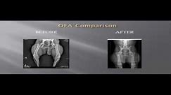 The Importance of "Precise Positioning Technique™" for OFA radiographs for Canine Hip Dysplasia