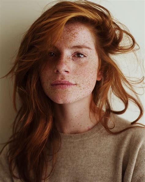 pin on freckles gingers red