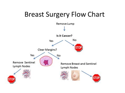 geezer chick breast cancer surgical flow chart