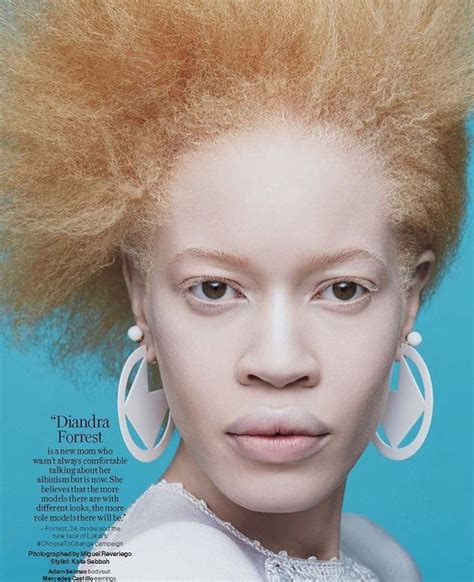 121 Best Albino Images On Pinterest Albino Beautiful