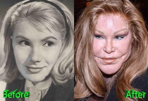 Catwoman Plastic Surgery From Bad To Worse
