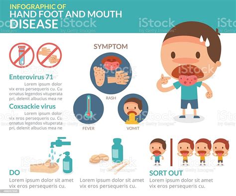hand foot and mouth disease infographic stock vector art and more images