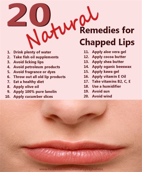 remedies  chapped lips musely