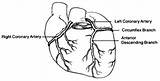 Coronary Heart Circulation Disease Arterial Figure sketch template