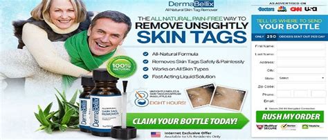 dermabellix where to buy the skin tag remover of choice