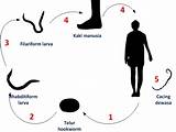 Hookworm Siklus Hidup Patogenesis Patologi sketch template