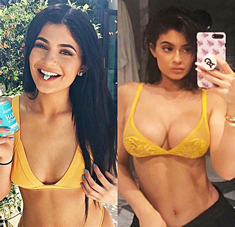 did kylie jenner get breast implants see before and after photos