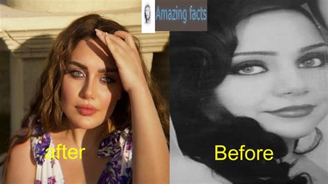 Zainab Fayyad In 2022 With New Features After Plastic Surgery The