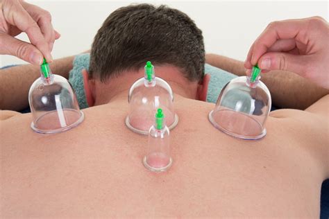 instrument assisted soft tissue mobilization cupping college station