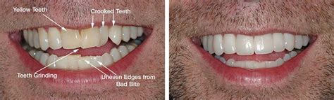 straight teeth   dentist teeth poster