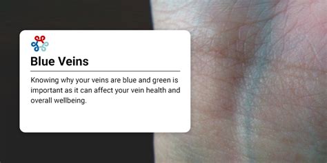 veins blue  green vein care center   york   jersey