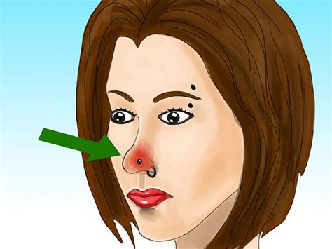 infected nose piercing causes symptoms remedies treatment