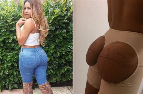 Big Brother S Lateysha Grace Wants More Plastic Surgery After Butt Lift