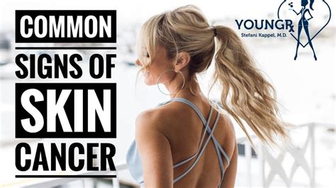 common signs of skin cancer youtube
