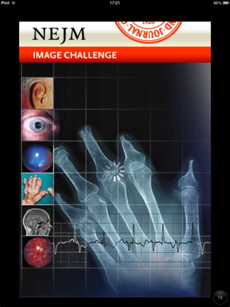 test  diagnostic skills   nejm image challenge app