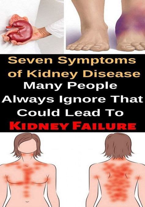 symptoms  kidney disease  people  ignore   lead  kidney failure