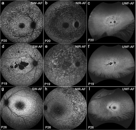 widespread flecks   shapes  distributions group iii  scientific