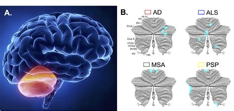 cerebellum  neurodegeneration    balance control