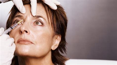 5 quick facts about treating wrinkles with botox everyday health
