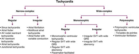 algorithm  differential diagnosis  ventricular tachycardia  images
